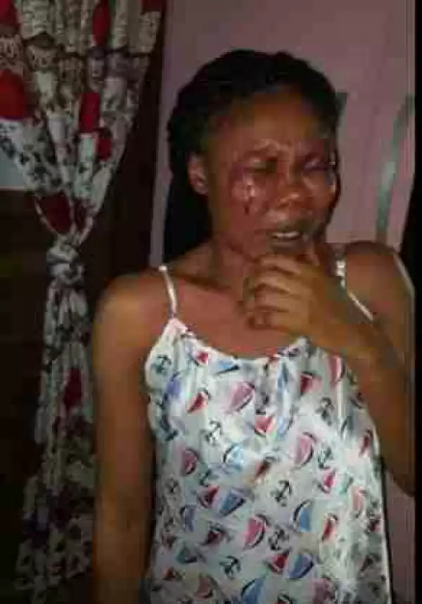 Domestic Violence: See What A Nigerian Man Did To His Wife (Graphic Photos)